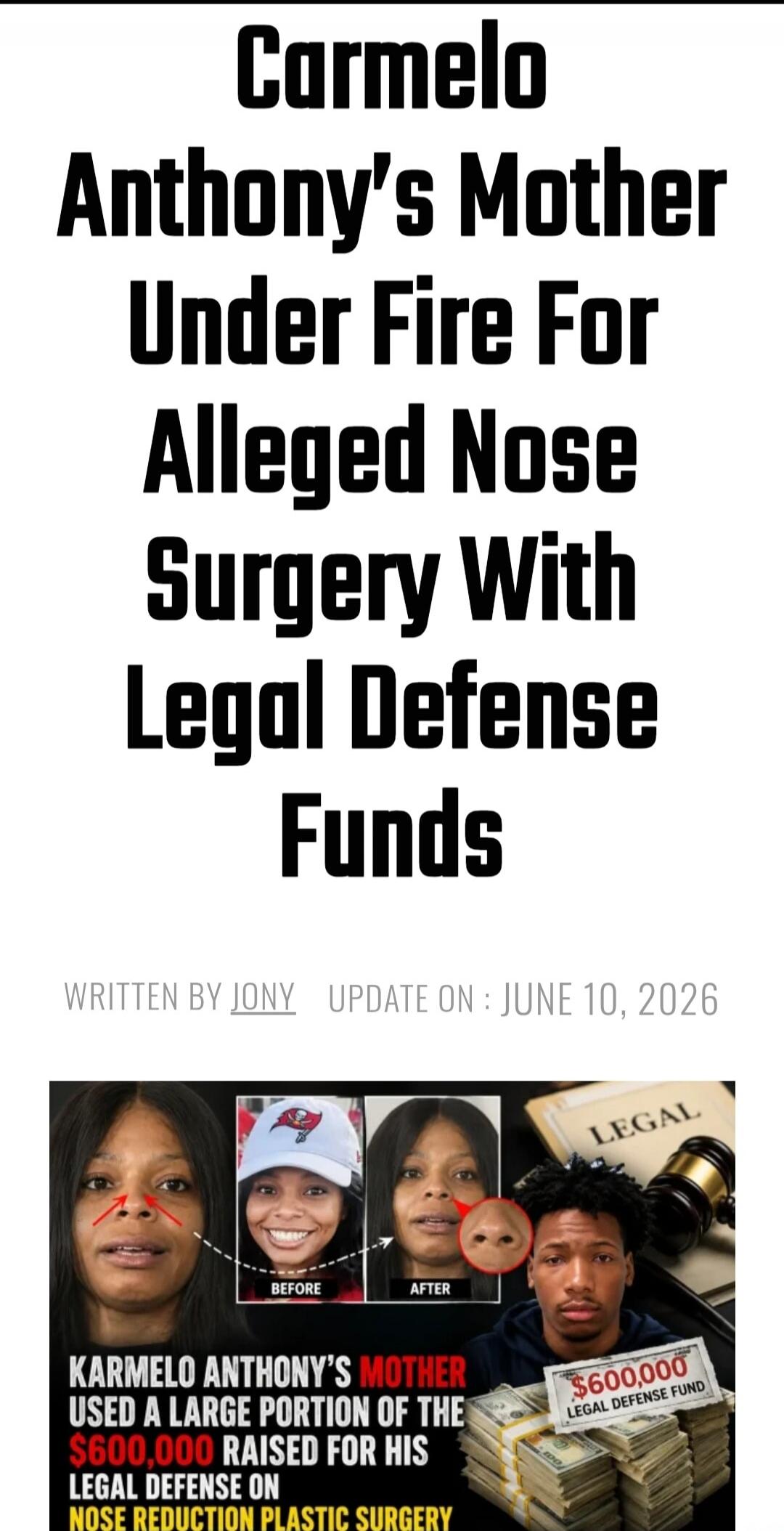 Carmelo Anthony's Mother Under Fire For Alleged Nose Surgery With Legal Defense Funds. WRITTEN BY JONY UPDATE ON : JUNE 10, 2026. BEFORE. AFTER. LEGAL. KARMELO ANTHONY'S MOTHER USED A LARGE PORTION OF THE $600,000 RAISED FOR HIS LEGAL DEFENSE ON NOSE REDUCTION PLASTIC SURGERY. $600,000 LEGAL DEFENSE FUND.