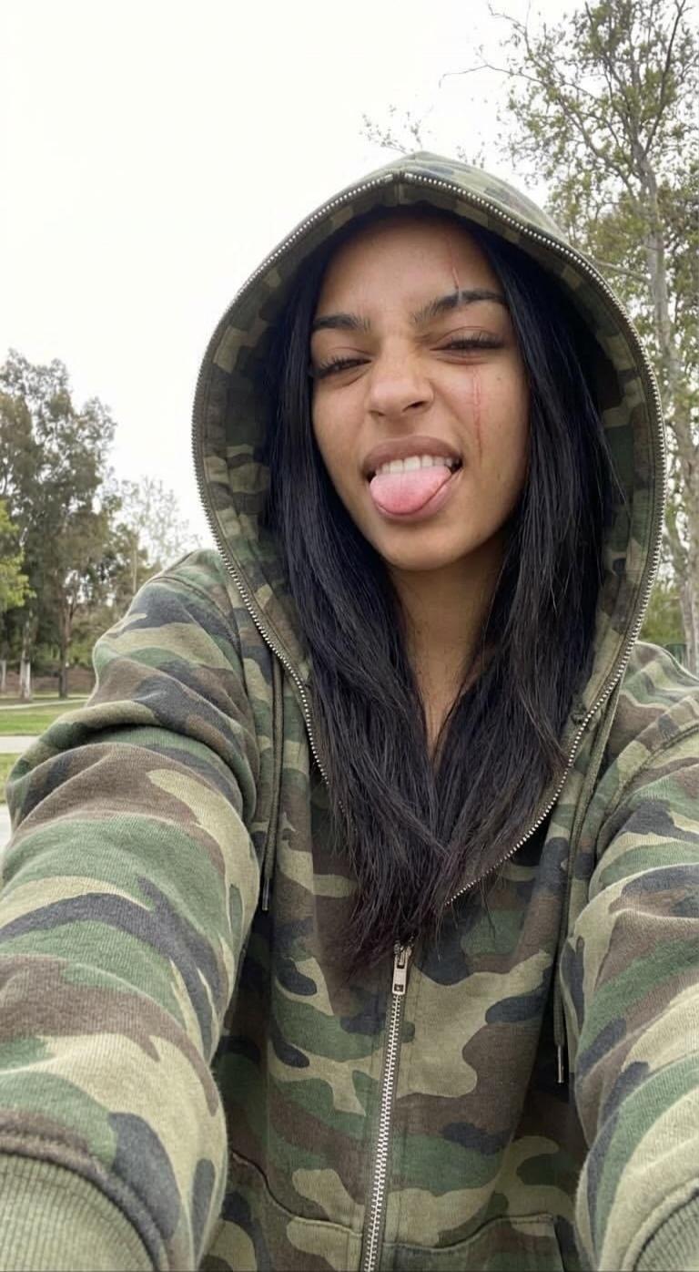 A young woman taking a selfie outdoors, wearing a camouflage hoodie and sticking her tongue out. She has a small facial scratch on her cheek.
