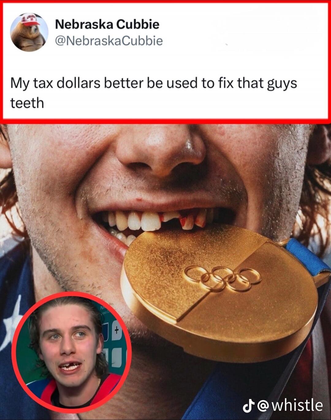 My tax dollars better be used to fix that guys teeth