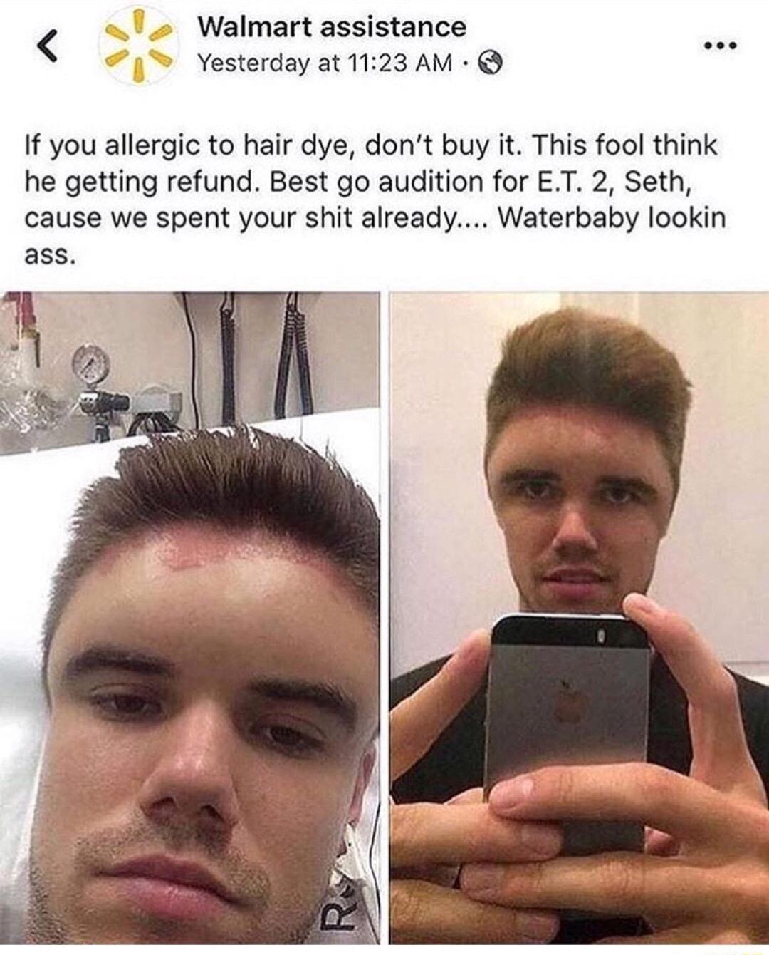 Walmart assistance o Yesterday at 1123 AM If you allergic to hair dye dont buy it This fool think he getting refund Best go audition for ET 2 Seth cause we spent your shit already Waterbaby lookin ass