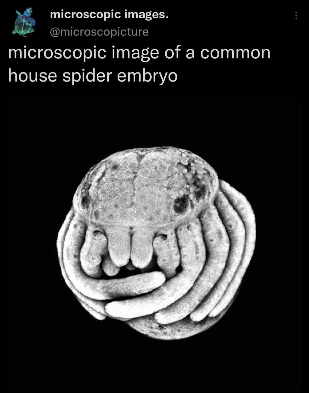 microscopic images microscopicture microscopic image of a common house spider embryo