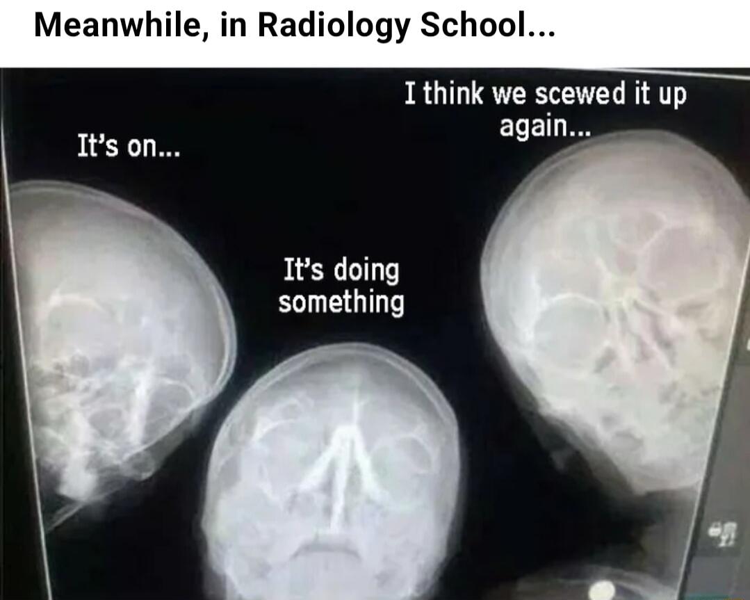 Meanwhile in Radiology School I think we scewed it up ELED Its doing something