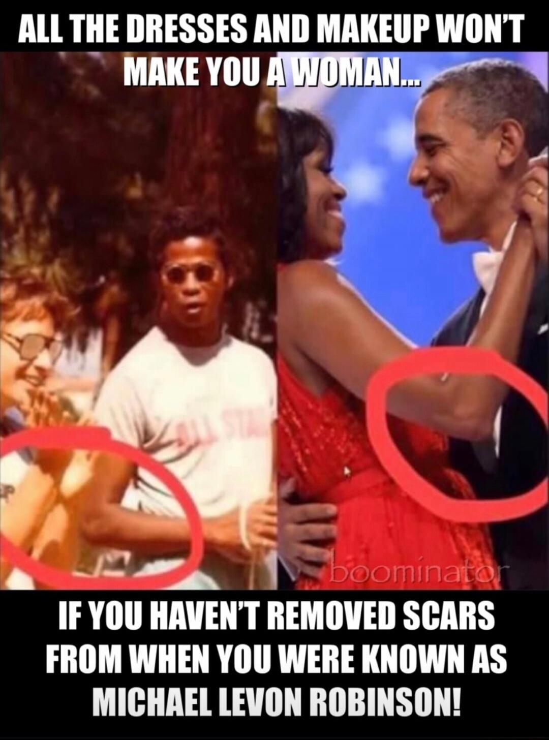 ALL THE DRESSES AND MAKEUP WON'T MAKE YOU A WOMAN... IF YOU HAVEN'T REMOVED SCARS FROM WHEN YOU WERE KNOWN AS MICHAEL LEVON ROBINSON!