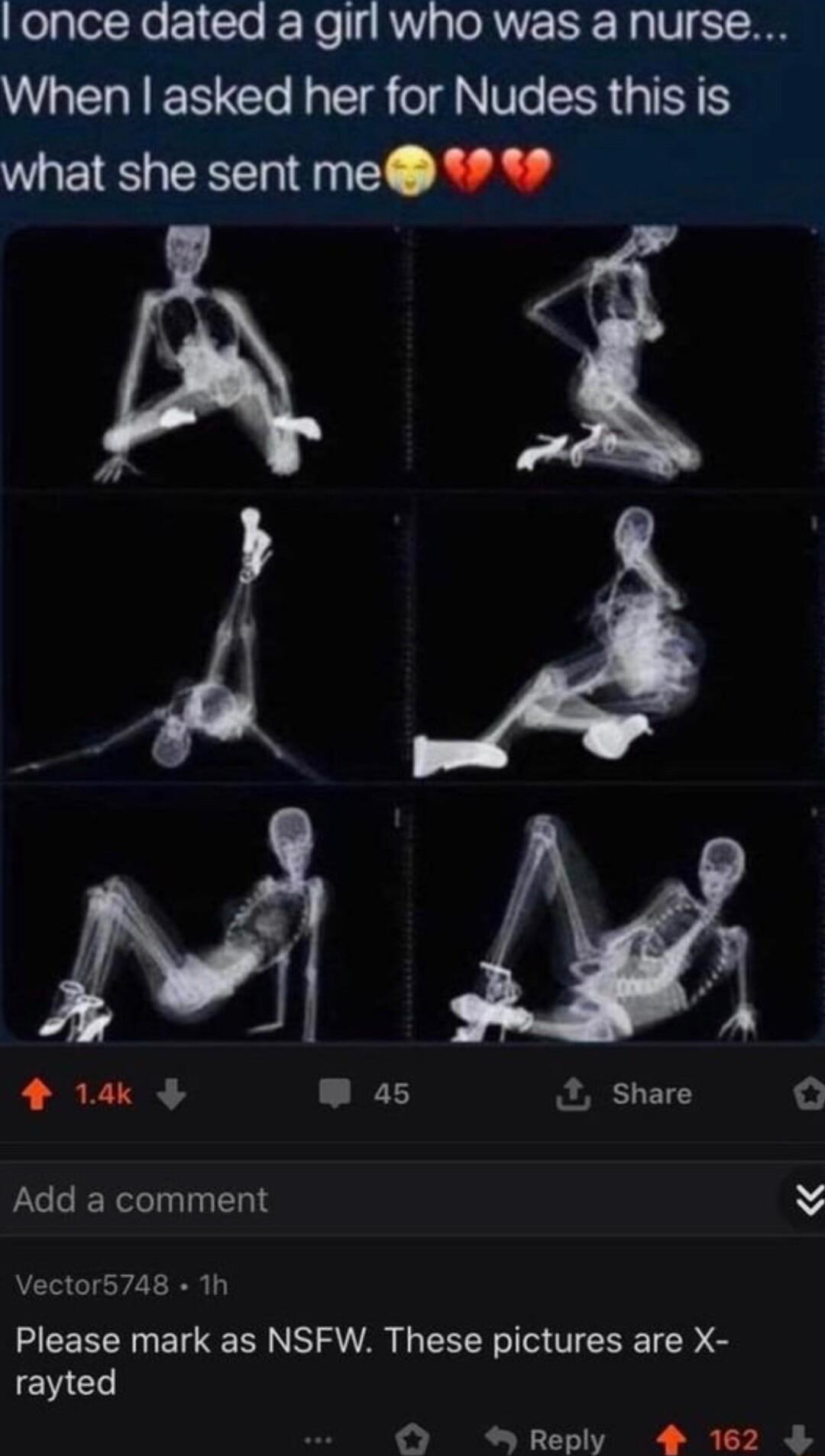 once dated a girl who was a nurse When asked her for Nudes this is what she sent me 9 LR 2 Share Add a comment Vector5748 1h Please mark as NSFW These pictures are X E G Reply 4 162