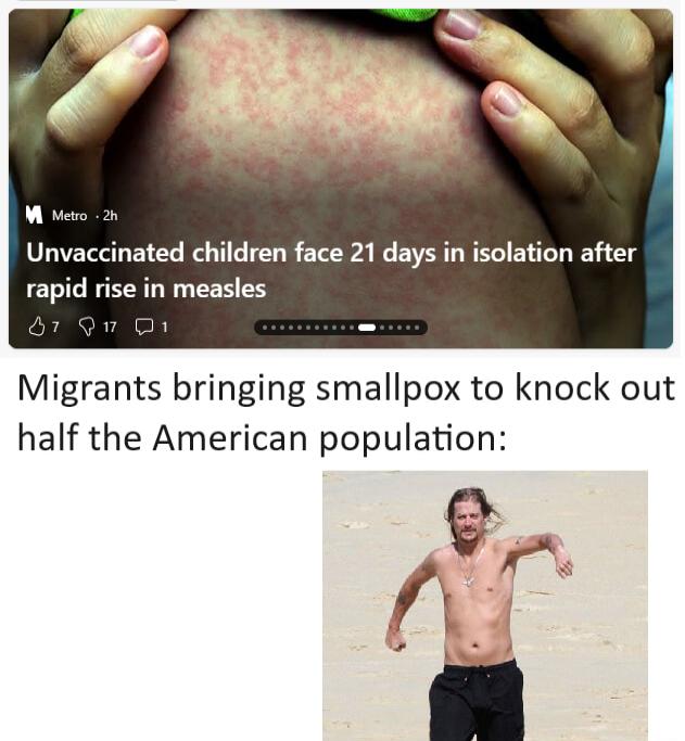 Unvaccinated children face 21 days in isolation after rapid rise in measles Migrants bringing smallpox to knock out half the American population