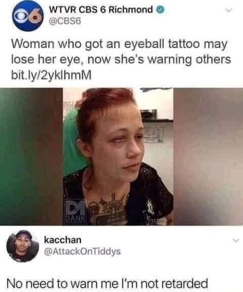 Woman who got an eyeball tattoo may lose her eye now shes warning others bitly2yklhmM kacchan AttackOnTiddys No need to warn me Im not retarded