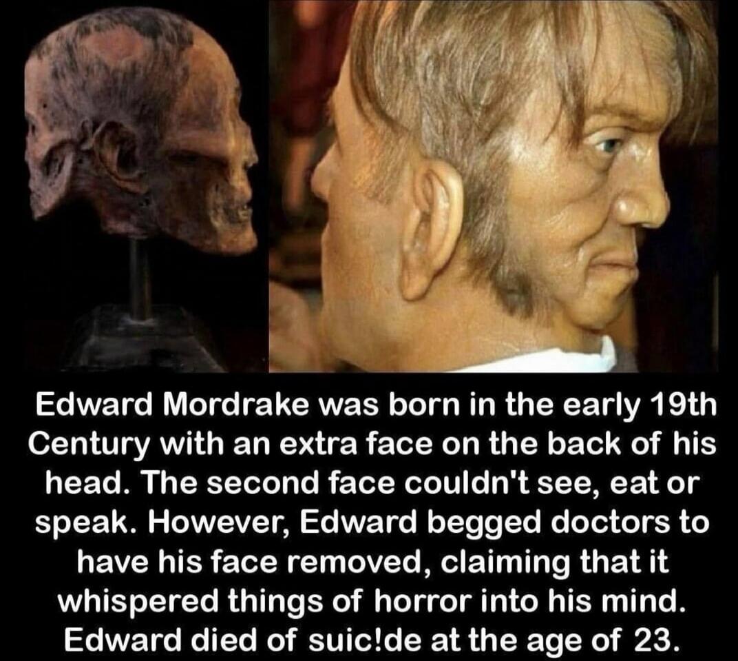 Edward Mordrake was born in the early 19th Century with an extra face on the back of his head. The second face couldn't see, eat or speak. However, Edward begged doctors to have his face removed, claiming that it whispered things of horror into his mind. Edward died of suicide at the age of 23.