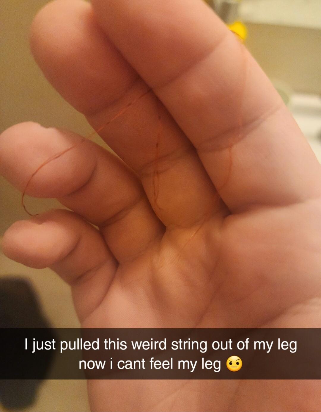 just pulled this weird string out of my leg now i cant feel my leg