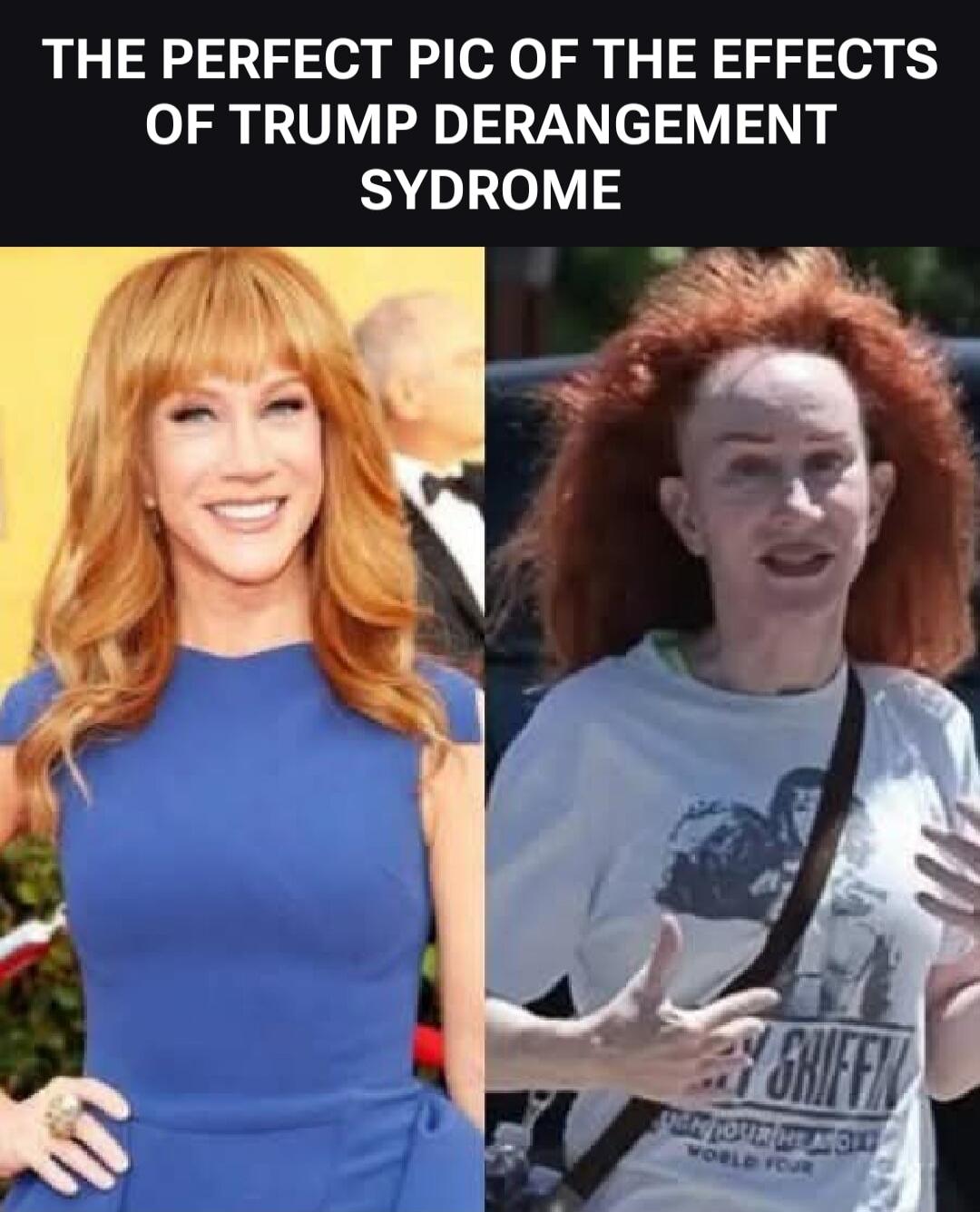 THE PERFECT PIC OF THE EFFECTS OF TRUMP DERANGEMENT SYNDROME. A split image showing Kathy Griffin. On the left, she is glamorous with styled red hair and a blue dress. On the right, she appears disheveled with messy red hair and a casual white t-shirt.