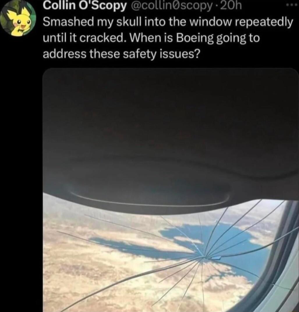 Collin OScopy Smashed my skull into the window repeatedly until it cracked When is Boeing going to address these safety issues