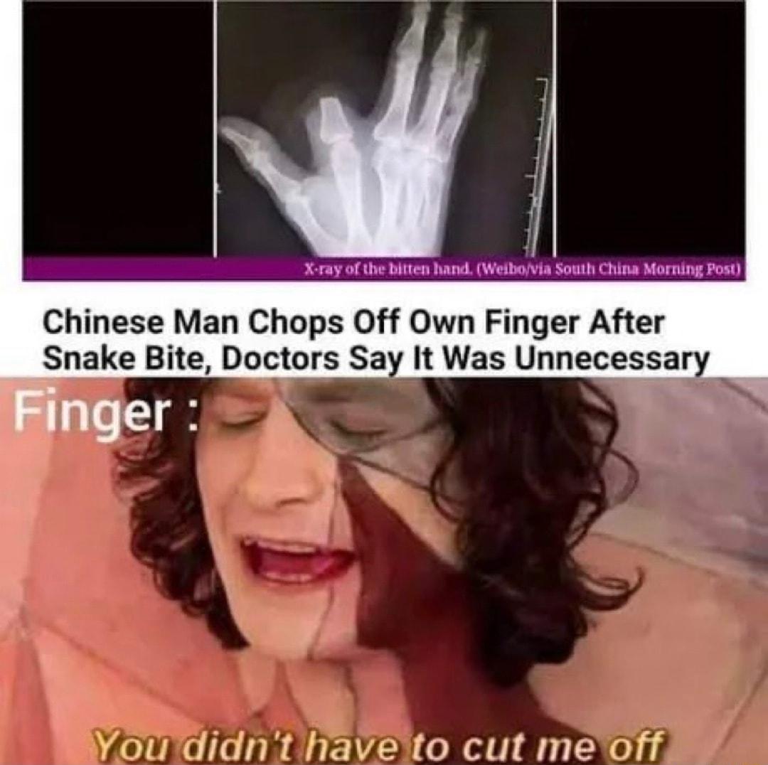 X ay of the i Welboria St China Morning Pos Chinese Man Chops Off Own Finger After Snake Bite Doctors Say It Was Unnecessar oudidnt haveto cut meoff
