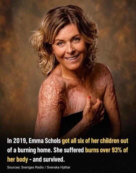 In 2019, Emma Schols got all six of her children out of a burning home. She suffered burns over 93% of her body - and survived. Sources: Sveriges Radio / Svenska Hjältar