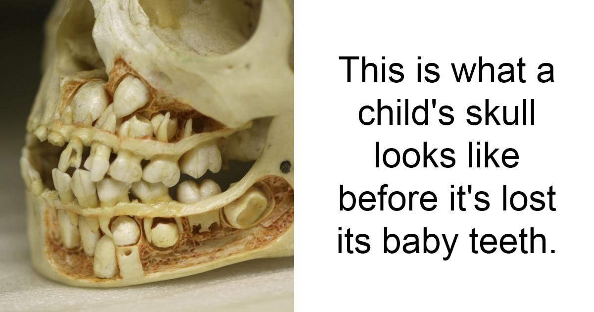 This is what a childs skull looks like before its lost its baby teeth