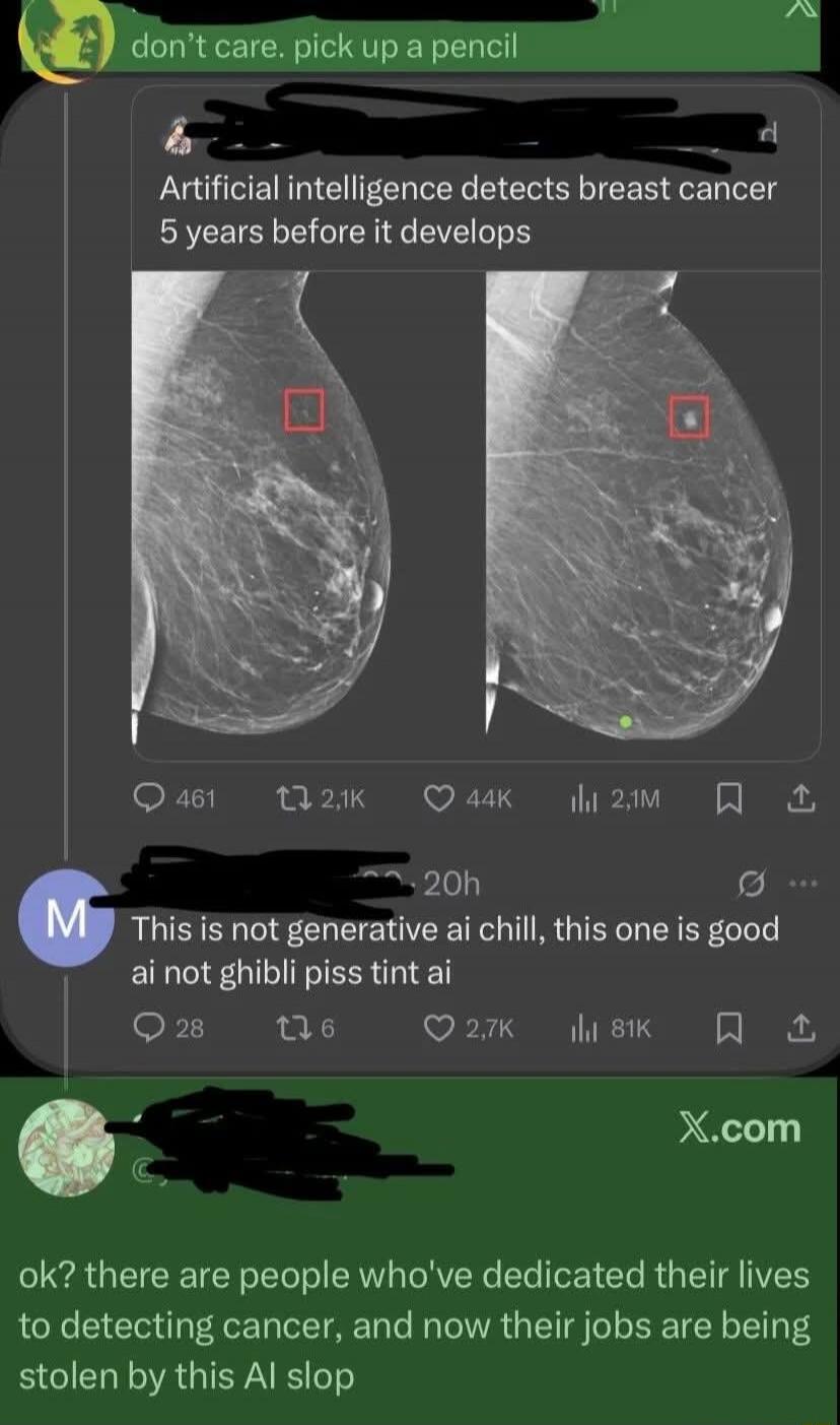 Artificial intelligence detects breast cancer 5 years before it develops