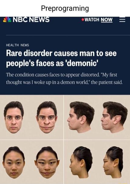 NEW WATCH NOW HEALTH NEWS Rare disorder causes man to see peoples faces as demonic The condition causes faces to appear distorted My first thought was I woke up in a demon world the patient said