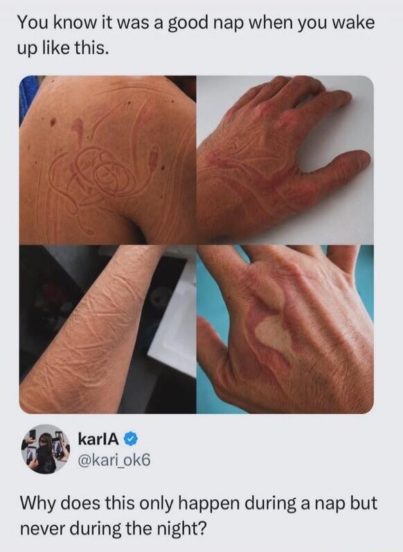 You know it was a good nap when you wake up like this. karlA @kari_ok6 Why does this only happen during a nap but never during the night?