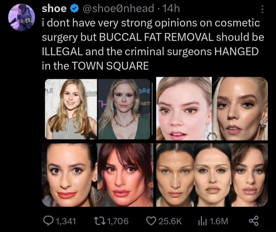 shoe shoenhead 14h i i dont have very strong opinions on cosmetic surgery but BUCCAL FAT REMOVAL should be ILLEGAL and the criminal surgeons HANGED in the TOWN SQUARE Q1341 1706 Q256K li16M 4