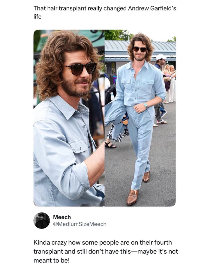 That hair transplant really changed Andrew Garfield's life Kinda crazy how some people are on their fourth transplant and still don't have this—maybe it's not meant to be!