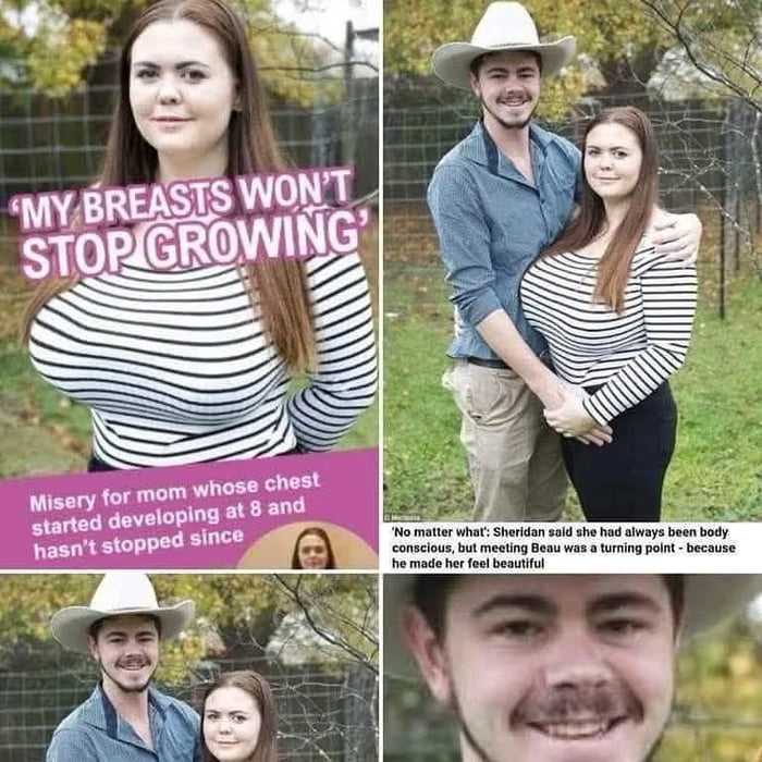 MY BREASTS WON'T STOP GROWING
Misery for mom whose chest started developing at 8 and hasn't stopped since
No matter what! Sheridan said she had always been body conscious, but meeting Beau was a turning point - because he made her feel beautiful