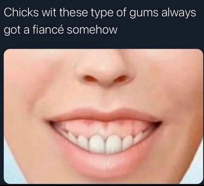 Chicks wit these type of gums always got a fiancée somehow