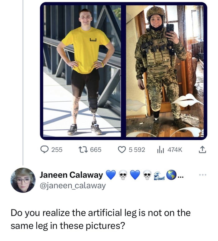 Q255 lees U552 amk A janeen_calaway e Janeen Calaway Do you realize the artificial leg is not on the same leg in these pictures