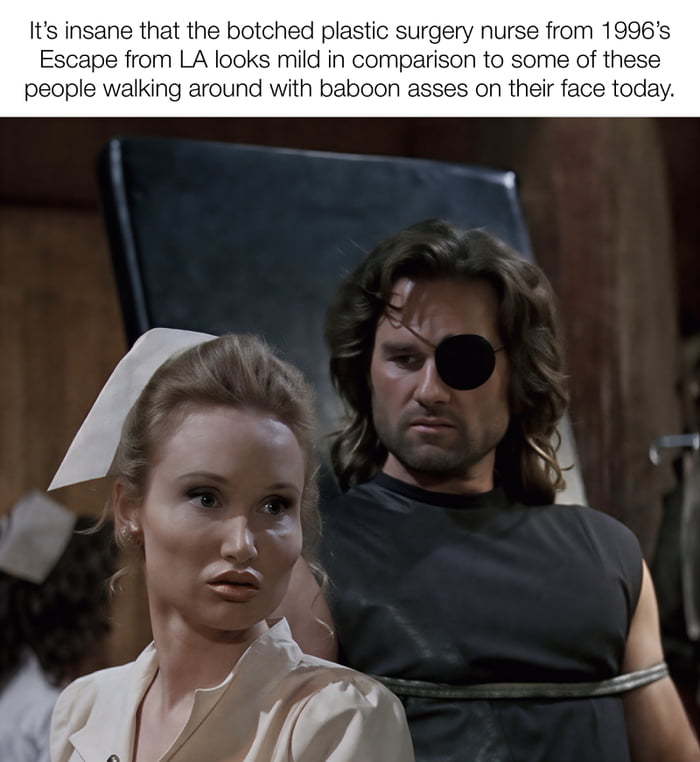 It's insane that the botched plastic surgery nurse from 1996's Escape from LA looks mild in comparison to some of these people walking around with baboon asses on their face today.