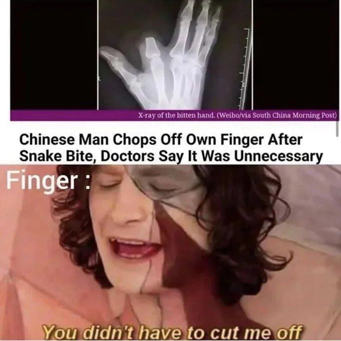 Chinese Man Chops Off Own Finger After _Snake Bite Doctors Say It Was Unnecessar Youdidnt haveto cut meoff