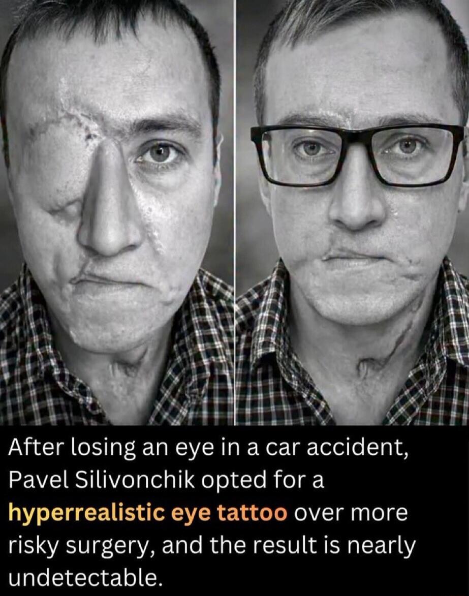 After losing an eye in a car accident, Pavel Silivonchik opted for a hyperrealistic eye tattoo over more risky surgery, and the result is nearly undetectable.