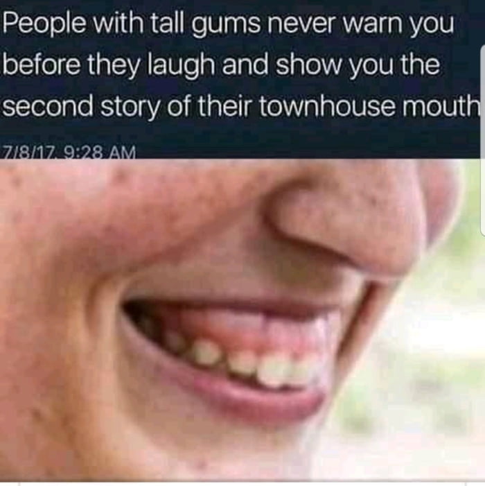 People with tall gums never warn you before they laugh and show you the second story of their townhouse mout