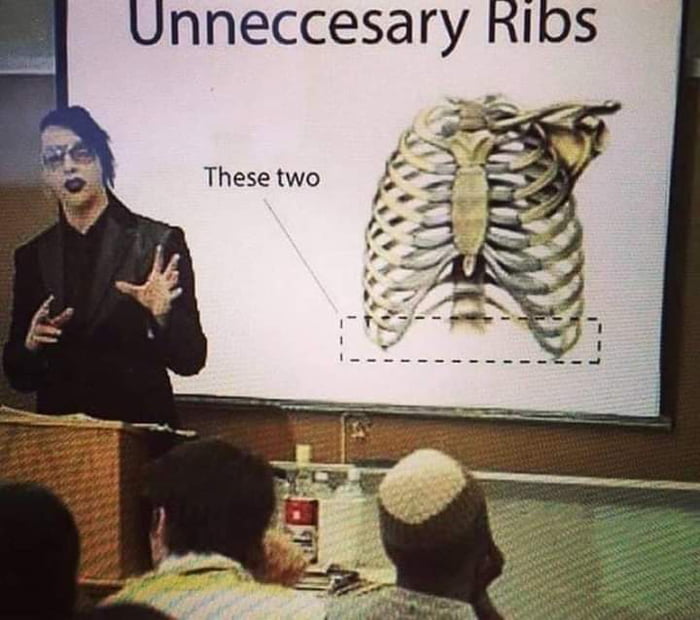 unneccesary RIos