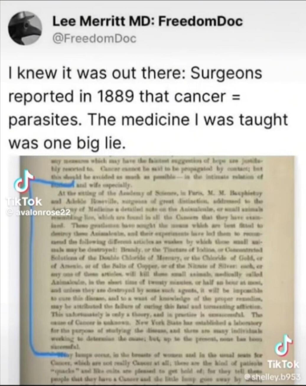 I knew it was out there: Surgeons reported in 1889 that cancer = parasites. The medicine I was taught was one big lie.
