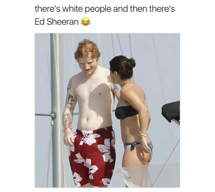 theres white people and then theres Ed Sheeran 2