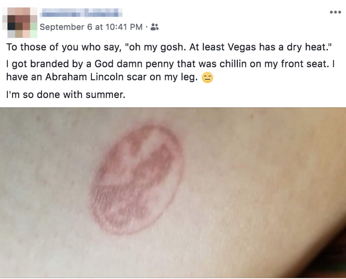 e l September 6 at 1041 PM To those of you who say oh my gosh At least Vegas has a dry heat got branded by a God damn penny that was chillin on my front seat have an Abraham Lincoln scar on my leg Im so done with summer