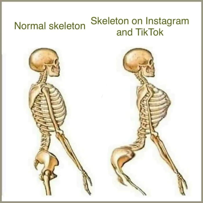 Skeleton on Instagram and TikTok Normal skeleton