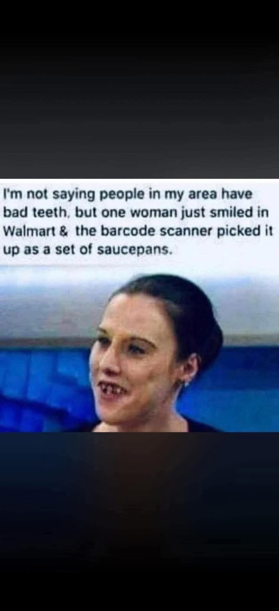 I'm not saying people in my area have bad teeth, but one woman just smiled in Walmart & the barcode scanner picked it up as a set of saucepans.