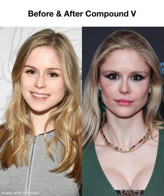 Before After Compound V