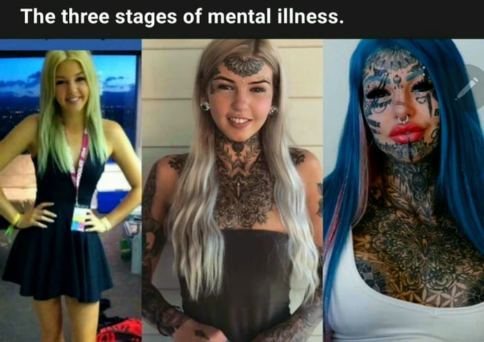 The three stages of mental illness