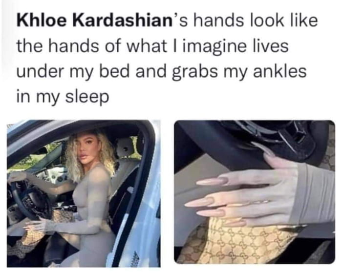 Khloe Kardashians hands look like the hands of what imagine lives under my bed and grabs my ankles in my sleep