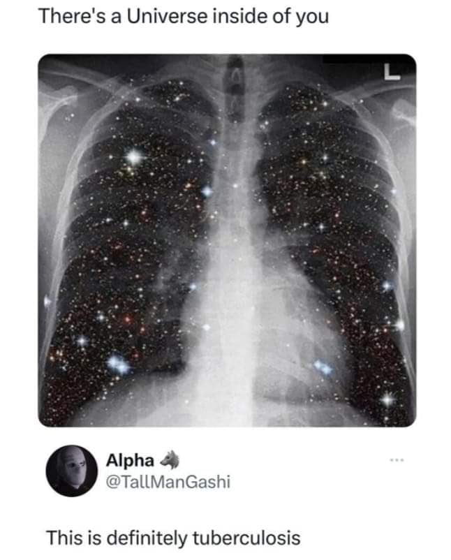 Theres a Universe inside of you Alpha TallManGashi This is definitely tuberculosis