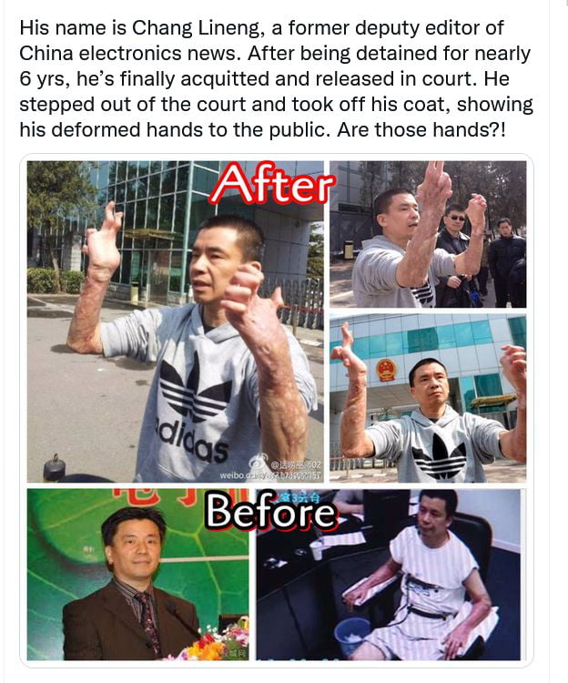 His name is Chang Lineng a former deputy editor of China electronics news After being detained for nearly 6 yrs hes finally acquitted and released in court He stepped out of the court and took off his coat showing his deformed hands to the public Are those hands