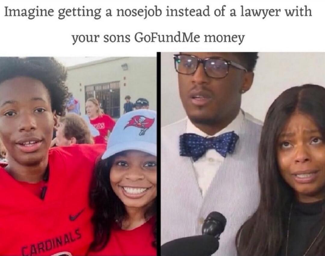 Imagine getting a nosejob instead of a lawyer with your sons GoFundMe money