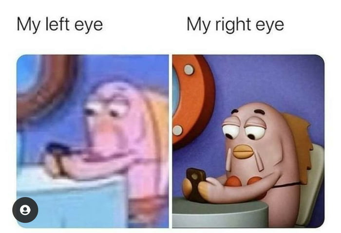 My left eye My right eye