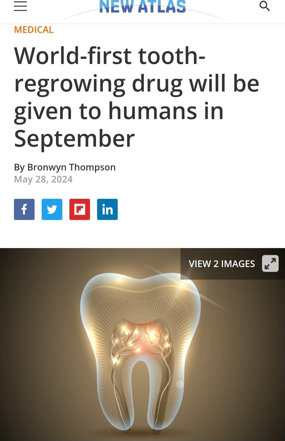 NEWAILAS Q World first tooth regrowing drug will be given to humans in September By Bronwyn Thompson May 28 2024 aoon view 2 imaces g