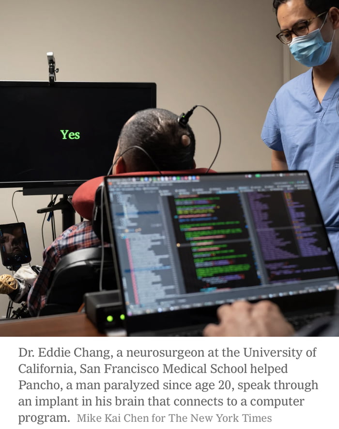 Dr Eddie Chang a neurosurgeon at the University of California San Francisco Medical School helped Pancho a man paralyzed since age 20 speak through an implant in his brain that connects to a computer program