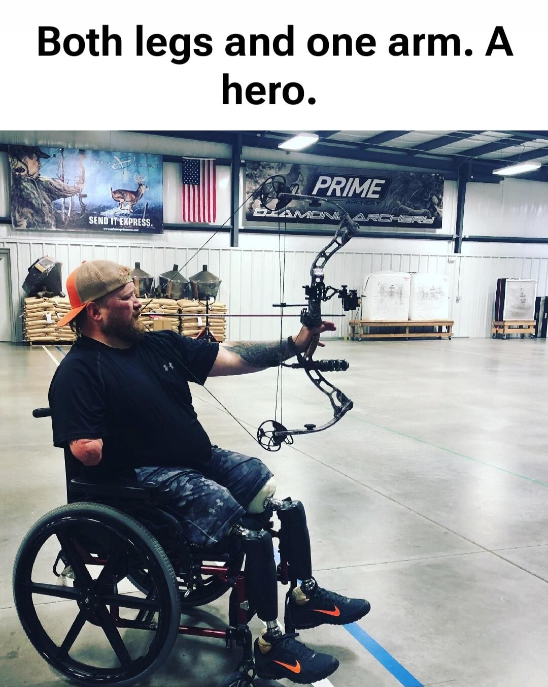 Both legs and one arm. A hero.