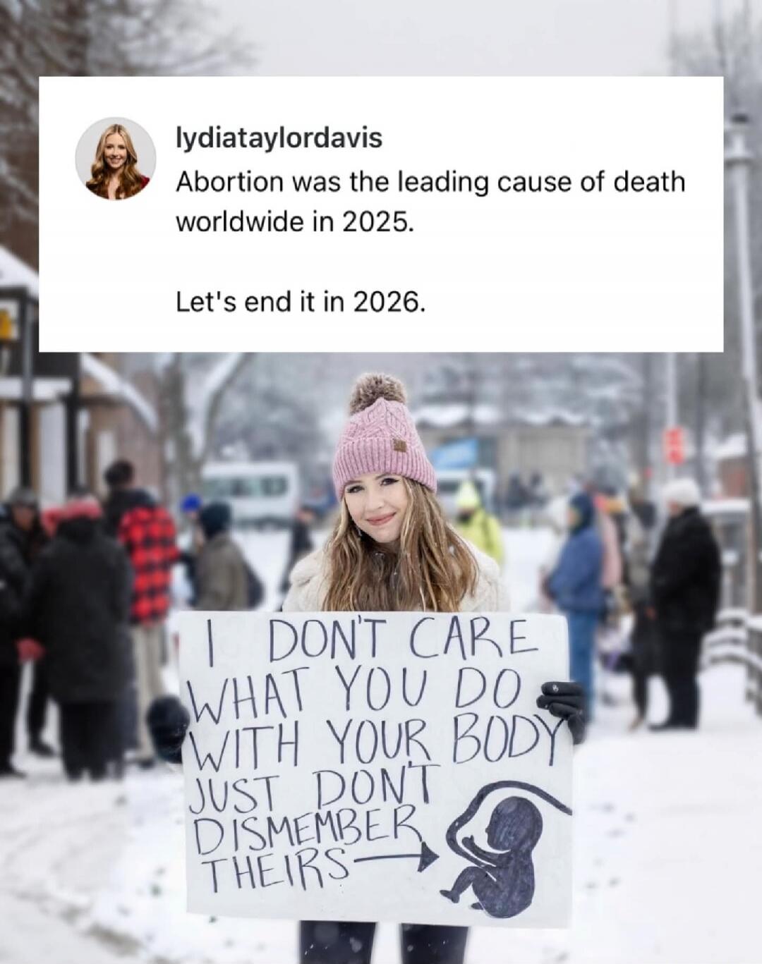 Abortion was the leading cause of death worldwide in 2025. Let's end it in 2026. I don't care what you do with your body just don't dismember theirs
