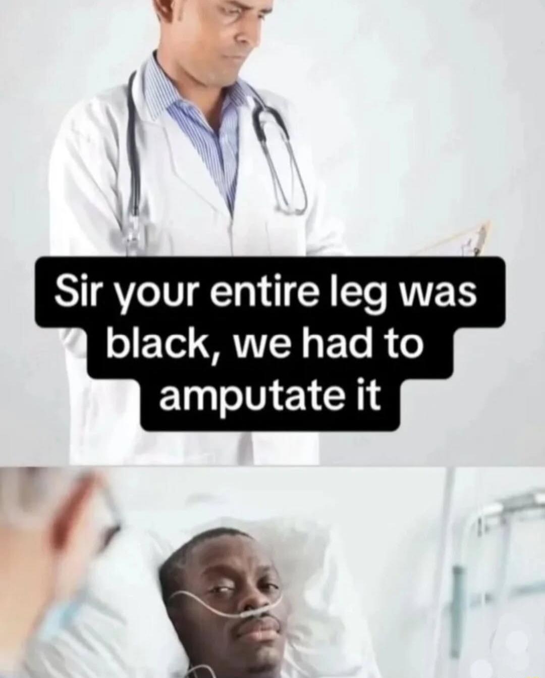 Sir your entire leg was o F Tel RTTT R T B o amputate it