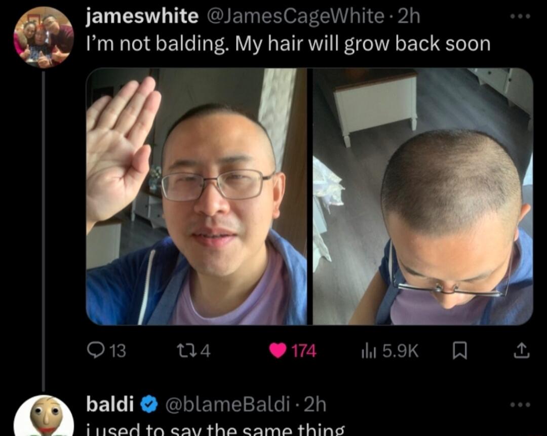 jameswhite JamesCageWhite 2h Im not balding My hair will grow back soon Y 1 u 9174 59K R u baldi lameBaldi 2t AR U R SRR i s