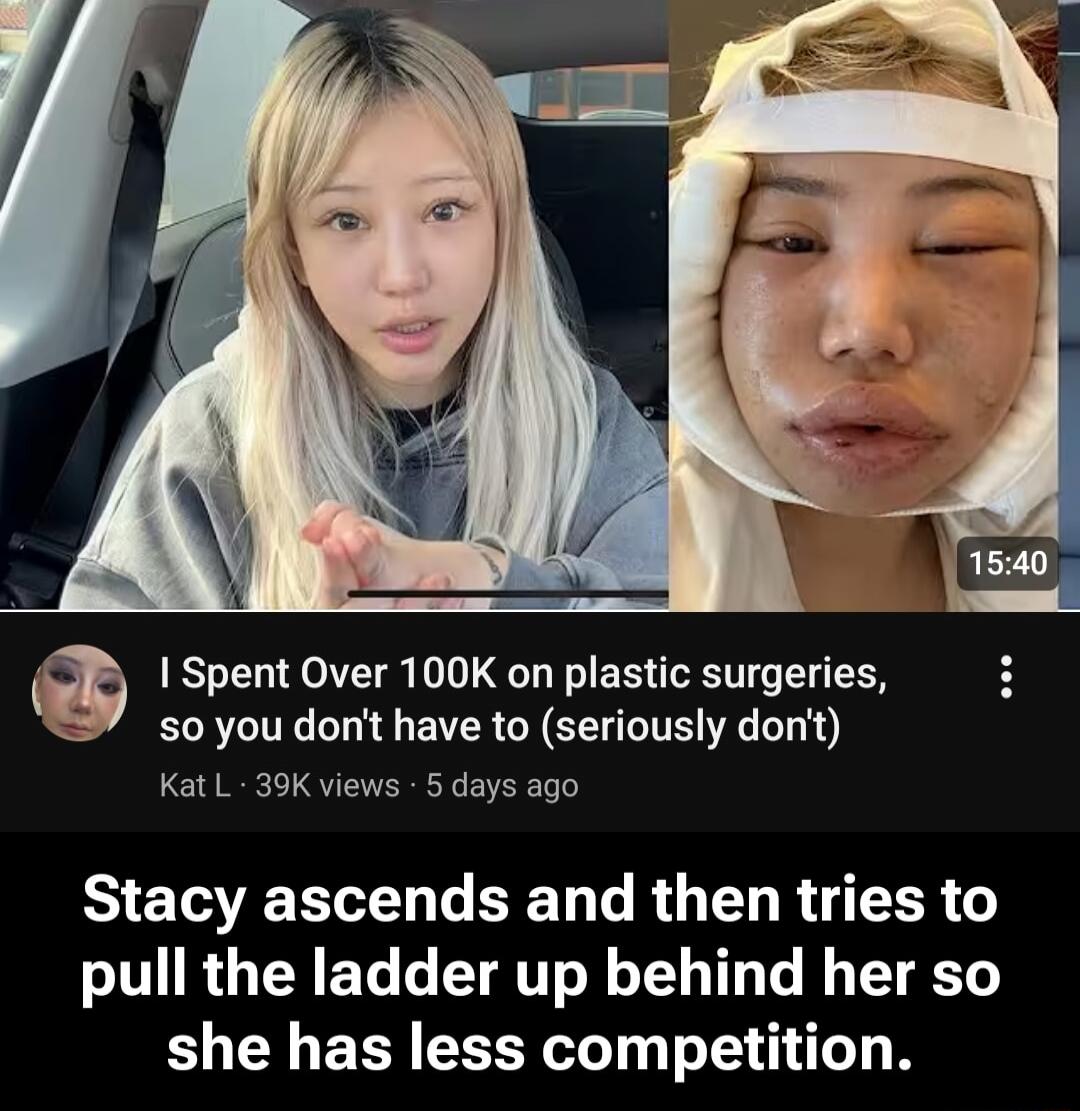 I Spent Over 100K on plastic surgeries, so you don't have to (seriously don't)