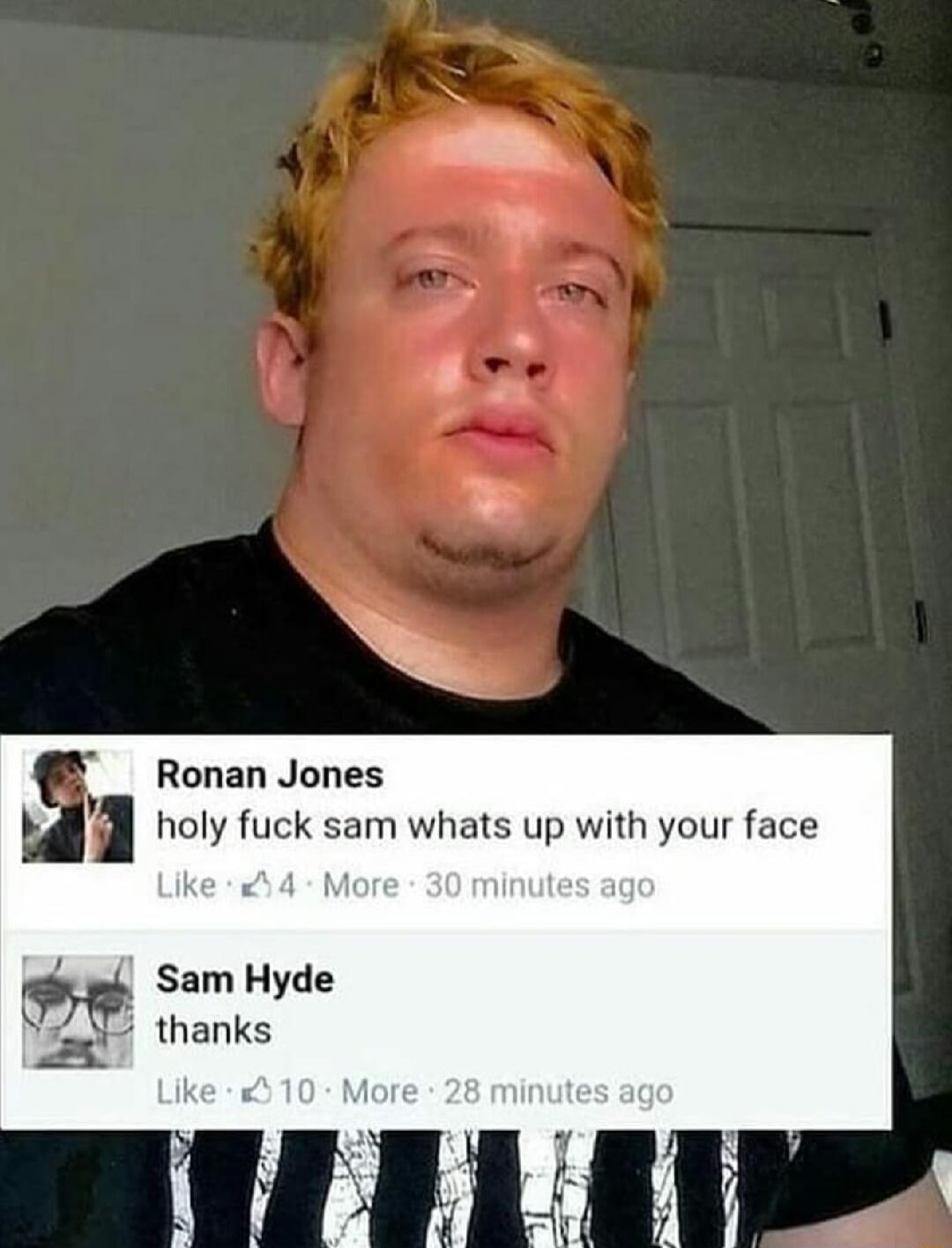 Ronan Jones holy fuck sam whats up with your face Sam Hyde thanks